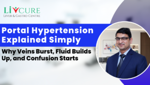 Portal Hypertension Explained: Causes, Symptoms & Treatment