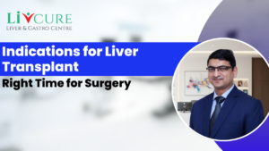 Indications for Liver Transplant: Right Time for Surgery