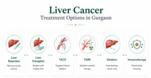 liver-cancer-treatment-options-in-gurgaon