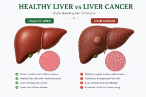 Healthy-liver-vs-liver-cancer-infographic-showing-structural-differences-and-tumour-changes