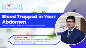 Recurrent Hospitalisations in Cirrhosis: A Hidden Signal for Transplant Referral