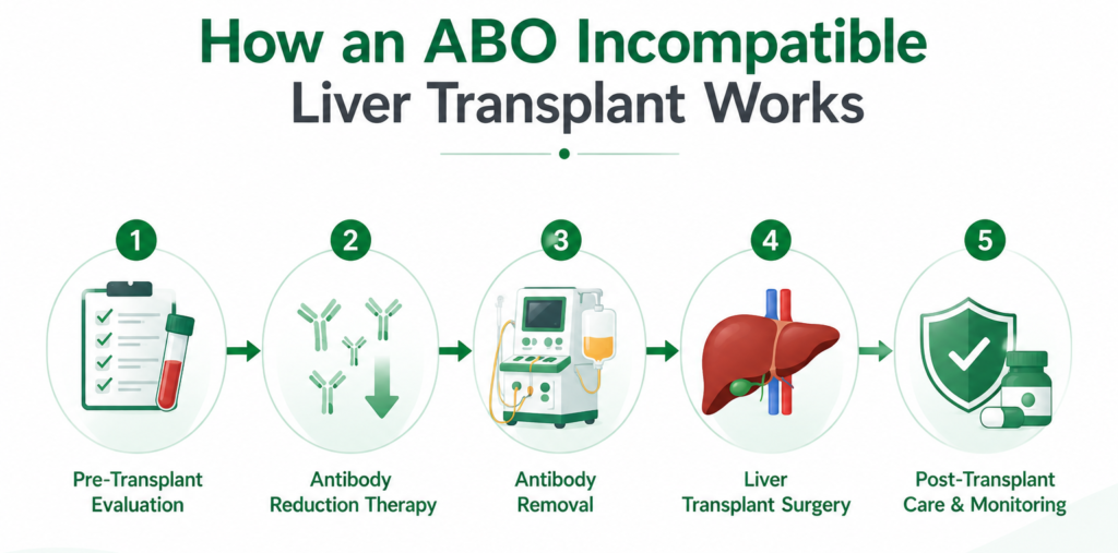 How an ABO incompatible liver transplant works step-by-step