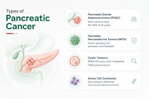 types-of-pancreatic-cancer
