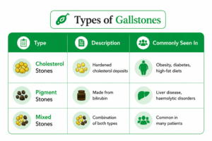 Infographic showing different types of gallstones including cholesterol stones, pigment stones, and mixed stones with descriptions, causes, and common risk factors such as obesity, diabetes, liver disease, and haemolytic disorders.