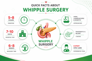 understanding whipple surgery