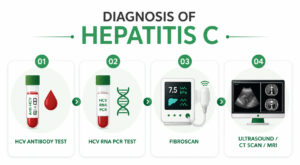 Diagnosis of Hepatitis C showing HCV antibody test, HCV RNA PCR test, FibroScan, and ultrasound CT MRI imaging 