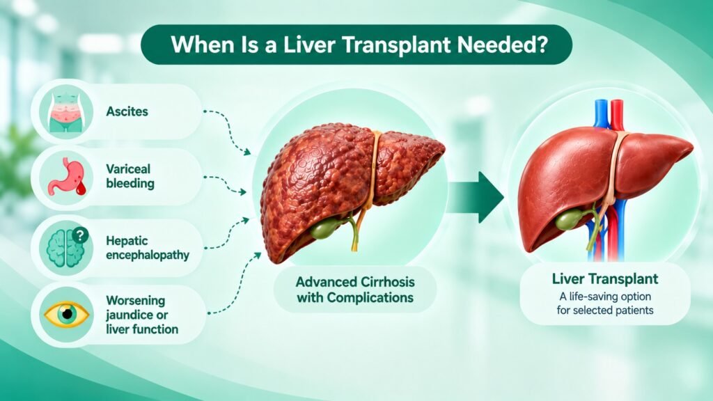 when is a liver tranplant needed graphic